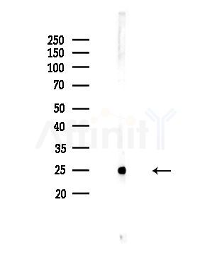 Mob3C Antibody - Western blot analysis of lysates from COLO205 cells, using Mob3C Antibody at 1/1000 dilution.