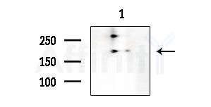 MPP1 Antibody - Western blot analysis of extracts from COLO205 cells, using MPP1 Antibody at 1/1000 dilution.