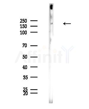 MPP1 Antibody - Western blot analysis of lysates from Mouse brain, using MPP1 Antibody at 1/1000 dilution.