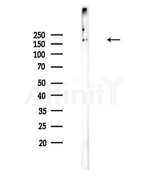 MPP1 Antibody - Western blot analysis of lysates from COLO205 cells, using MPP1 Antibody at 1/1000 dilution.