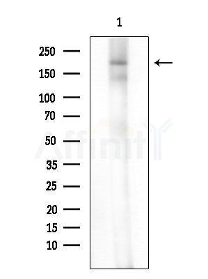 MRCKbeta Antibody - Western blot analysis of extracts from B16F10-LUC cells(heat-shock treatment), using MRCKbeta Antibody at 1/1000 dilution.