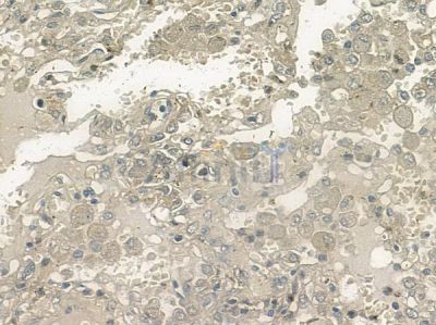 MRCKbeta Antibody - AF9116 at 1/100 staining human normal lung tissue by IHC-P.
