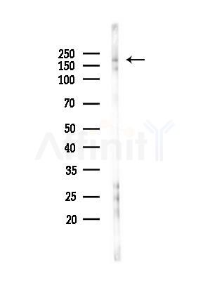 MRCKbeta Antibody - Western blot analysis of lysates from B16F10-LUC cells(heat-shock,45min treatment), using MRCKbeta Antibody at 1/1000 dilution.