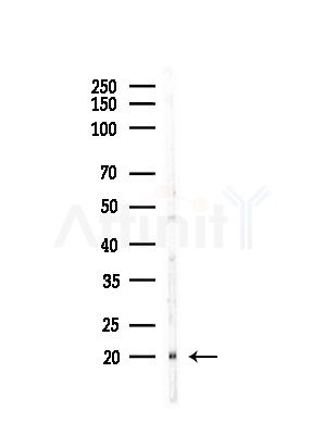 NDUFS5 Antibody - Western blot analysis of lysates from HepG2 cells(LPS,4h treatment), using NDUFS5 Antibody at 1/1000 dilution.