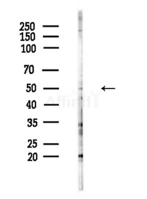 NFATc2IP Antibody - Western blot analysis of lysates from Hela cells(LPS,4h treatment), using NFATc2IP Antibody at 1/1000 dilution.
