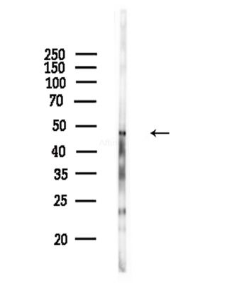NFATc2IP Antibody - Western blot analysis of lysates from COLO205 cells(heat-shock,45min treatment), using NFATc2IP Antibody at 1/1000 dilution.