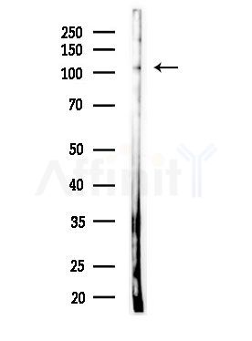 NFRKB Antibody - Western blot analysis of lysates from MDA-MB-231 cells(heat-shock,45min treatment), using NFRKB Antibody at 1/1000 dilution.