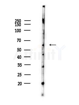 Nicalin Antibody - Western blot analysis of lysates from HepG2 cells(heat-shock,45min treatment), using Nicalin Antibody at 1/1000 dilution.