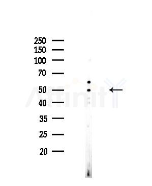 NMUR1 Antibody - Western blot analysis of lysates from COLO205 cells, using NMUR1 Antibody at 1/1000 dilution.
