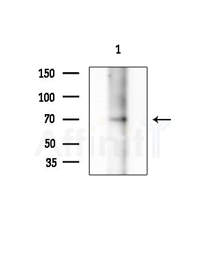 Nox3 Antibody - Western blot analysis of extracts from B16F10-LUC cells(heat-shock treatment), using Nox3 Antibody at 1/1000 dilution.