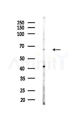 Nox3 Antibody - Western blot analysis of lysates from HUVEC cells(starvation,24h treatment), using Nox3 Antibody at 1/1000 dilution.