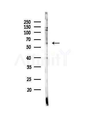 Nox3 Antibody - Western blot analysis of lysates from B16F10-LUC cells(heat-shock,45min treatment), using Nox3 Antibody at 1/1000 dilution.