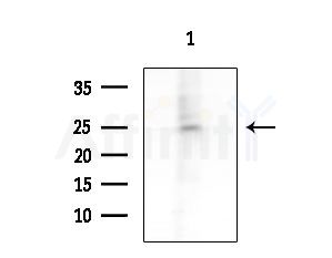 NRIP3 Antibody - Western blot analysis of extracts from Hela cells, using NRIP3 Antibody at 1/1000 dilution.