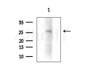 NRIP3 Antibody - Western blot analysis of extracts from Rat brain, using NRIP3 Antibody at 1/1000 dilution.