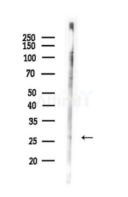 NRIP3 Antibody - Western blot analysis of lysates from Rat brain, using NRIP3 Antibody at 1/1000 dilution.