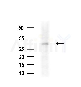 Olfactory receptor 2A42 Antibody - Western blot analysis of extracts from B16F10-LUC cells(starvation,24h treatment), using Olfactory receptor 2A42 Antibody at 1/1000 dilution.