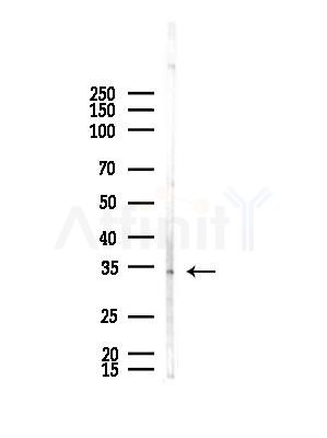 Olfactory receptor 2A42 Antibody - Western blot analysis of lysates from B16F10-LUC cells(starvation,24h treatment), using Olfactory receptor 2A42 Antibody at 1/1000 dilution.