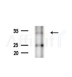 Olfactory receptor 51F2 Antibody - Western blot analysis of extracts from B16F10-LUC cells(starvation,24h treatment), using Olfactory receptor 51F2 Antibody at 1/1000 dilution.