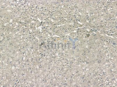 Olfactory receptor 51F2 Antibody - AF9141 at 1/100 staining human normal liver tissue by IHC-P.