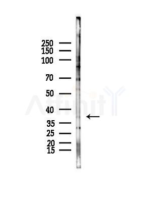 Olfactory receptor 51F2 Antibody - Western blot analysis of lysates from B16F10-LUC cells(starvation,24h treatment), using Olfactory receptor 51F2 Antibody at 1/1000 dilution.