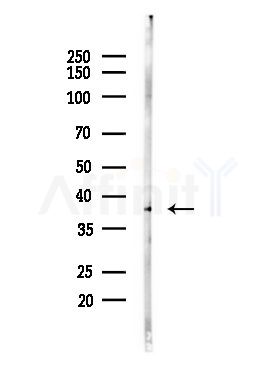 Olfactory receptor 52K1 Antibody - Western blot analysis of lysates from LoVo cells(heat-shock,45min treatment), using Olfactory receptor 52K1 Antibody at 1/1000 dilution.