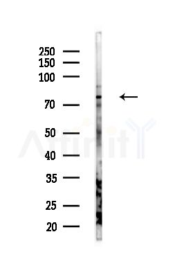 PAK5 Antibody - Western blot analysis of lysates from HUVEC cells(starvation,24h treatment), using PAK5 Antibody at 1/1000 dilution.