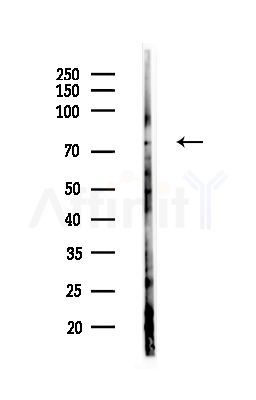 PAK5 Antibody - Western blot analysis of lysates from A375 cells(starvation,24h treatment), using PAK5 Antibody at 1/1000 dilution.