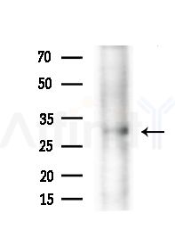 Peropsin Antibody - Western blot analysis of extracts from B16F10-LUC cells(starvation,24h treatment), using Peropsin Antibody at 1/1000 dilution.