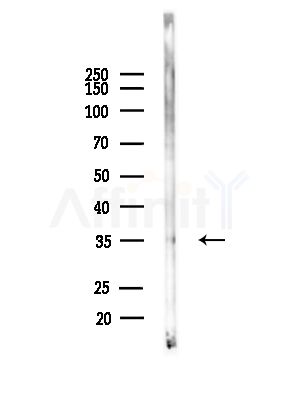 Peropsin Antibody - Western blot analysis of lysates from B16F10-LUC cells(starvation,24h treatment), using Peropsin Antibody at 1/1000 dilution.
