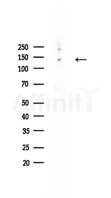 PHKA1/2 Antibody - Western blot analysis of lysates from HepG2 cells(heat-shock,45min treatment), using PHKA1/2 Antibody at 1/1000 dilution.