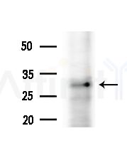 Pmp24 Antibody - Western blot analysis of extracts from B16F10-LUC cells(starvation,24h treatment), using Pmp24 Antibody at 1/1000 dilution.