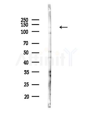 POLR3B Antibody - Western blot analysis of lysates from COLO205 cells(UV,30min treatment), using POLR3B Antibody at 1/1000 dilution.