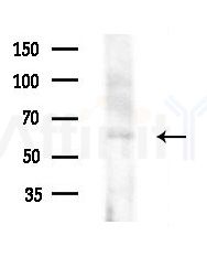 POTE-14/22 Antibody - Western blot analysis of extracts from Rat liver, using POTE-14/22 Antibody at 1/1000 dilution.