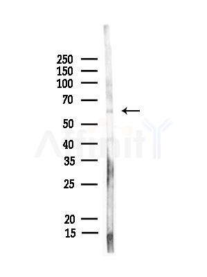 POTE-14/22 Antibody - Western blot analysis of lysates from Rat liver, using POTE-14/22 Antibody at 1/1000 dilution.
