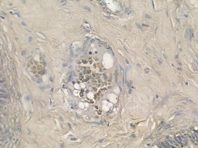 PRPF31 Antibody - AF9169 at 1/100 staining human testicular cancer by IHC-P.