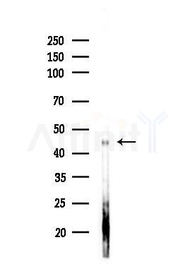 PSK-H1 Antibody - Western blot analysis of lysates from COLO205 cells(UV,30min treatment), using PSK-H1 Antibody at 1/1000 dilution.