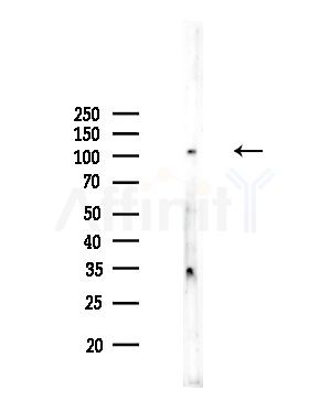 PTP IA-2beta Antibody - Western blot analysis of lysates from Rat testis, using PTP IA-2beta Antibody at 1/1000 dilution.
