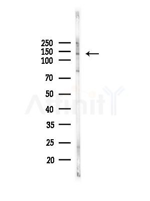 QSK Antibody - Western blot analysis of lysates from MCF7 cells(heat-shock,45min treatment), using QSK Antibody at 1/1000 dilution.