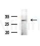 Rab 34 Antibody - Western blot analysis of extracts from B16F10-LUC cells(starvation,24h treatment), using Rab 34 Antibody at 1/1000 dilution.