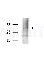 Rab 34 Antibody - Western blot analysis of extracts from Mouse testis, using Rab 34 Antibody at 1/1000 dilution.