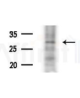 Rab 34 Antibody - Western blot analysis of extracts from Hela cells(heat-shock,45min treatment), using Rab 34 Antibody at 1/1000 dilution.