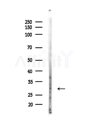 Rab 34 Antibody - Western blot analysis of lysates from Hela cells(heat-shock,45min treatment), using Rab 34 Antibody at 1/1000 dilution.