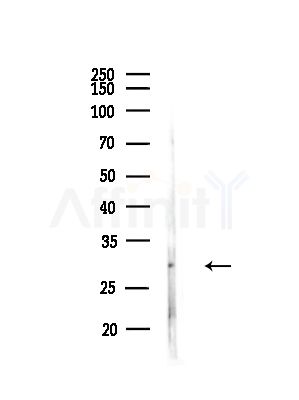 Rab 34 Antibody - Western blot analysis of lysates from B16F10-LUC cells(starvation,24h treatment), using Rab 34 Antibody at 1/1000 dilution.