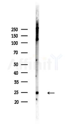 Rac1/2/3 Antibody - Western blot analysis of lysates from HepG2 cells(heat-shock,45min treatment), using Rac1/2/3 Antibody at 1/1000 dilution.