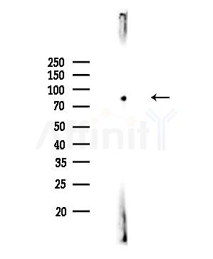 RFX3 Antibody - Western blot analysis of lysates from Rat testis, using RFX3 Antibody at 1/1000 dilution.