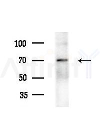 RHOBTB3 Antibody - Western blot analysis of extracts from HepG2 cells(starvation treatment), using RHOBTB3 Antibody at 1/1000 dilution.