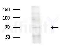 RHOBTB3 Antibody - Western blot analysis of extracts from EC304 cells(heat-shock treatment), using RHOBTB3 Antibody at 1/1000 dilution.