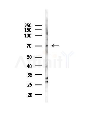 RHOBTB3 Antibody - Western blot analysis of lysates from HepG2 cells(starvation,24h treatment), using RHOBTB3 Antibody at 1/1000 dilution.