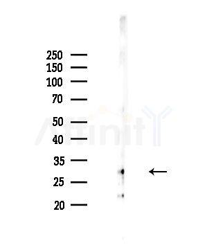 Ribosomal Protein S2 Antibody - Western blot analysis of lysates from COLO205 cells, using Ribosomal Protein S2 Antibody at 1/1000 dilution.