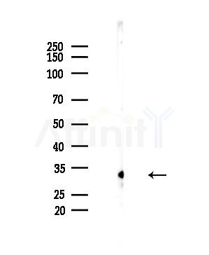 Ribosomal Protein S2 Antibody - Western blot analysis of lysates from EC304 cells, using Ribosomal Protein S2 Antibody at 1/1000 dilution.